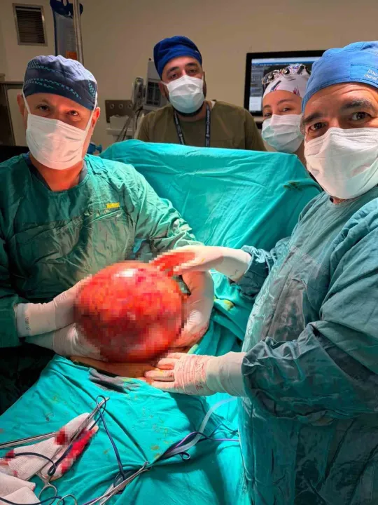 Kocaeli Şehir Hastanesi'nde doktorlar gözlerine inanamadı: 6,5 kilogramlık tümör çıkarıldı